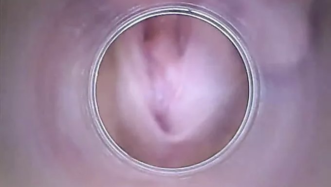 Amatör Esmer, Kuru Vajinasını Ve Serviksini Sergiliyor