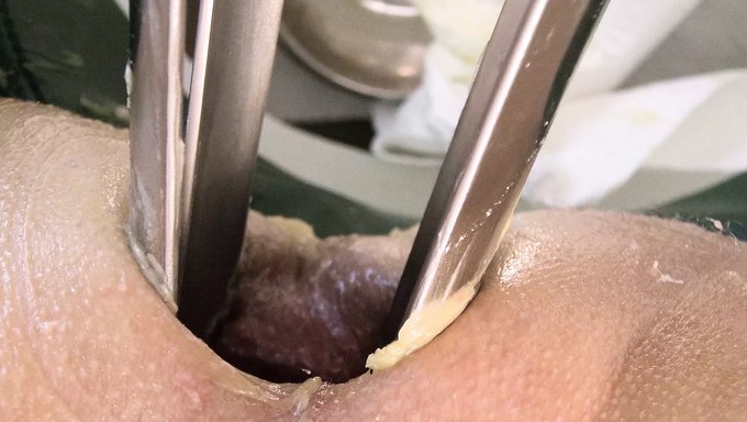 Doktor, Devasa At Spekulumu Ve Çift Fisting Ile Hemşireyi Beceriyor