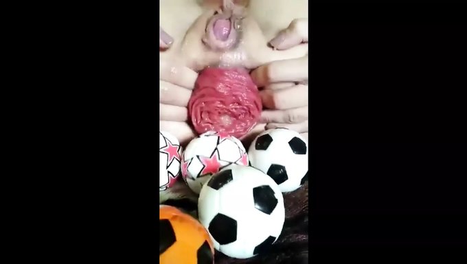 Anal Prolapsusla Aşırı Anal Penetrasyon